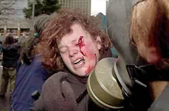 protester hit by police